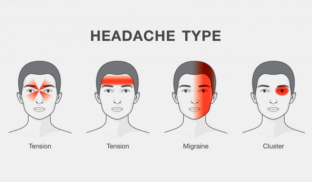 Baş ağrısı türleri nedir? Baş ağrısı nasıl geçer?